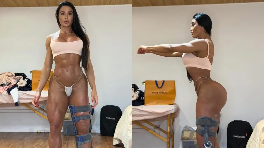 Gracyanne Barbosa Exibe Corpo Após Cirurgia Pós-Dança dos Famosos e Prioriza Saúde
